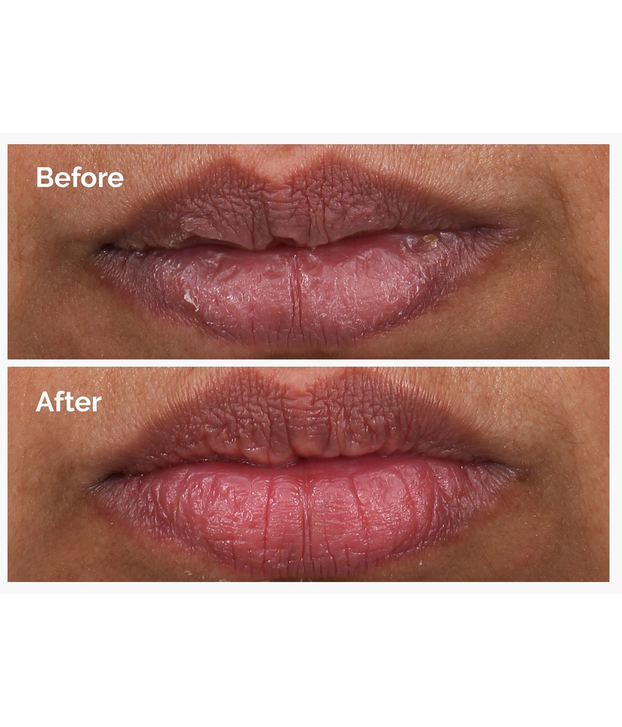 The Ordinary PHA 5% Exfoliating Lip Serum 15ml