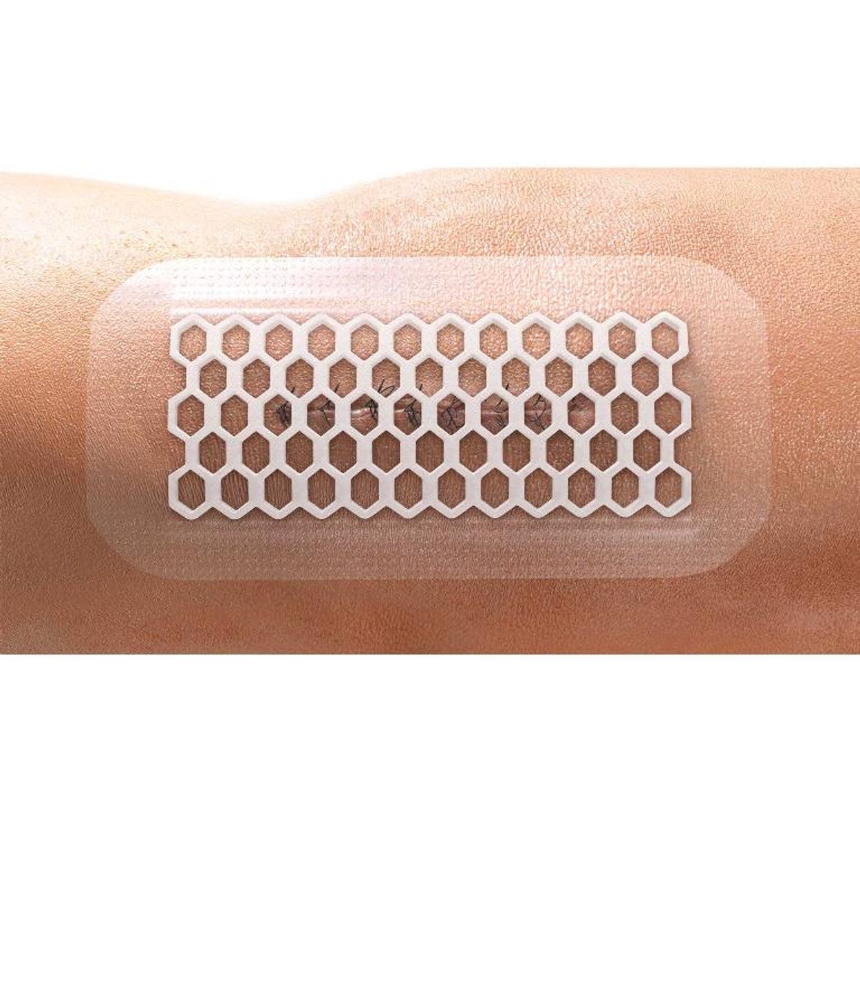 OP-Site  Post-Op  Visible 10 x 8cm