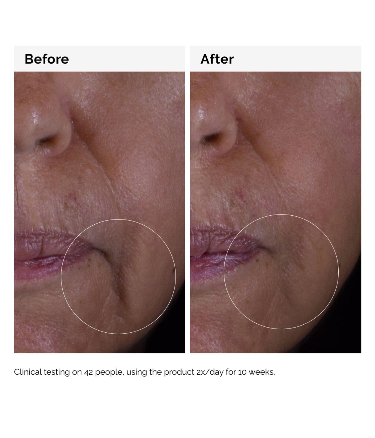 The Ordinary GF 15% Solution 30ml