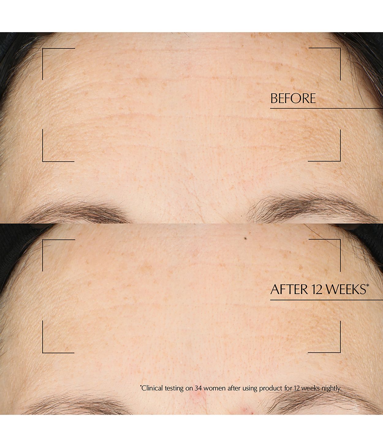 ESTÉE LAUDER ANR Overnight Treatment 65ml