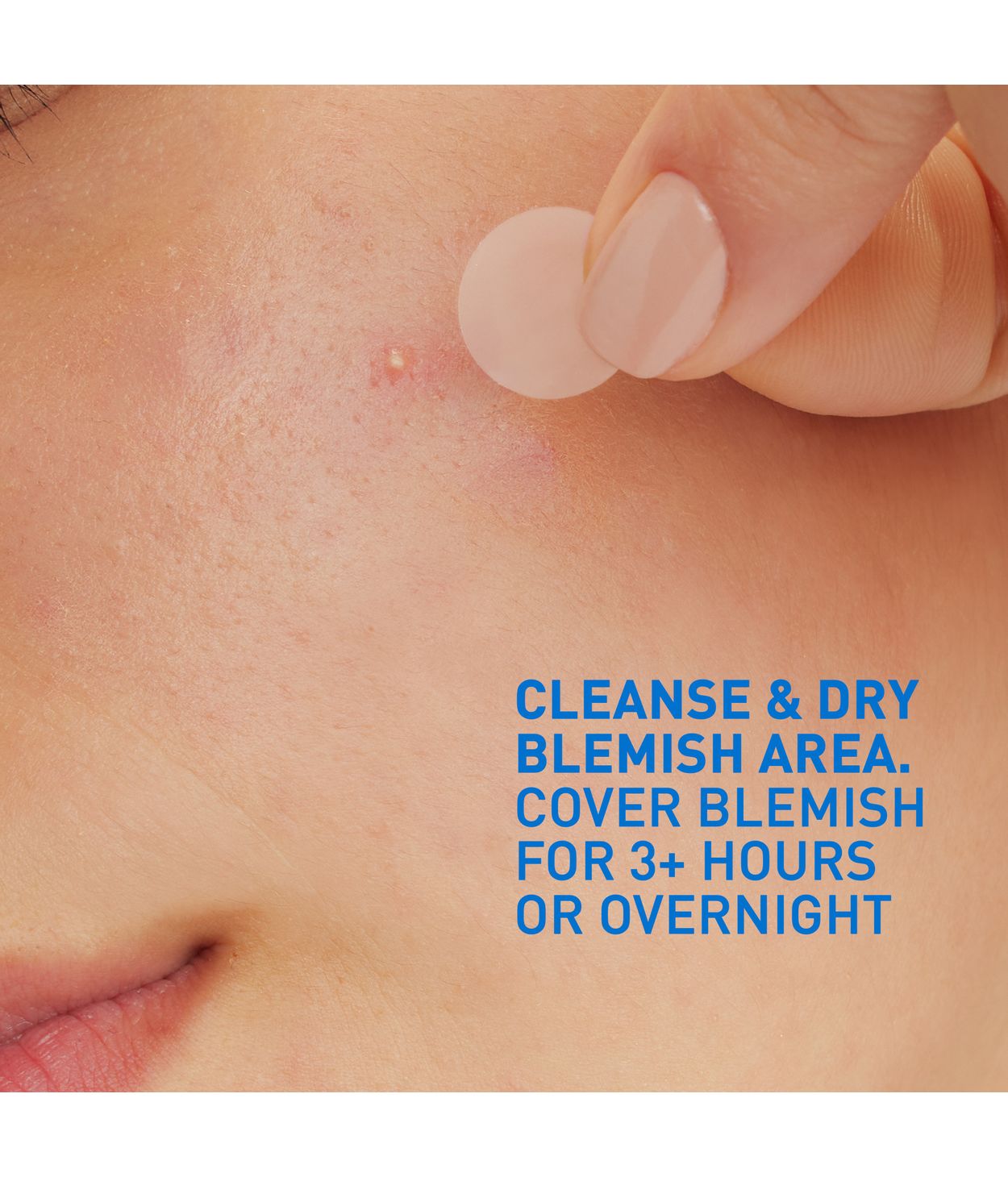 CeraVe Blemish Control Barrier Patches 22stk