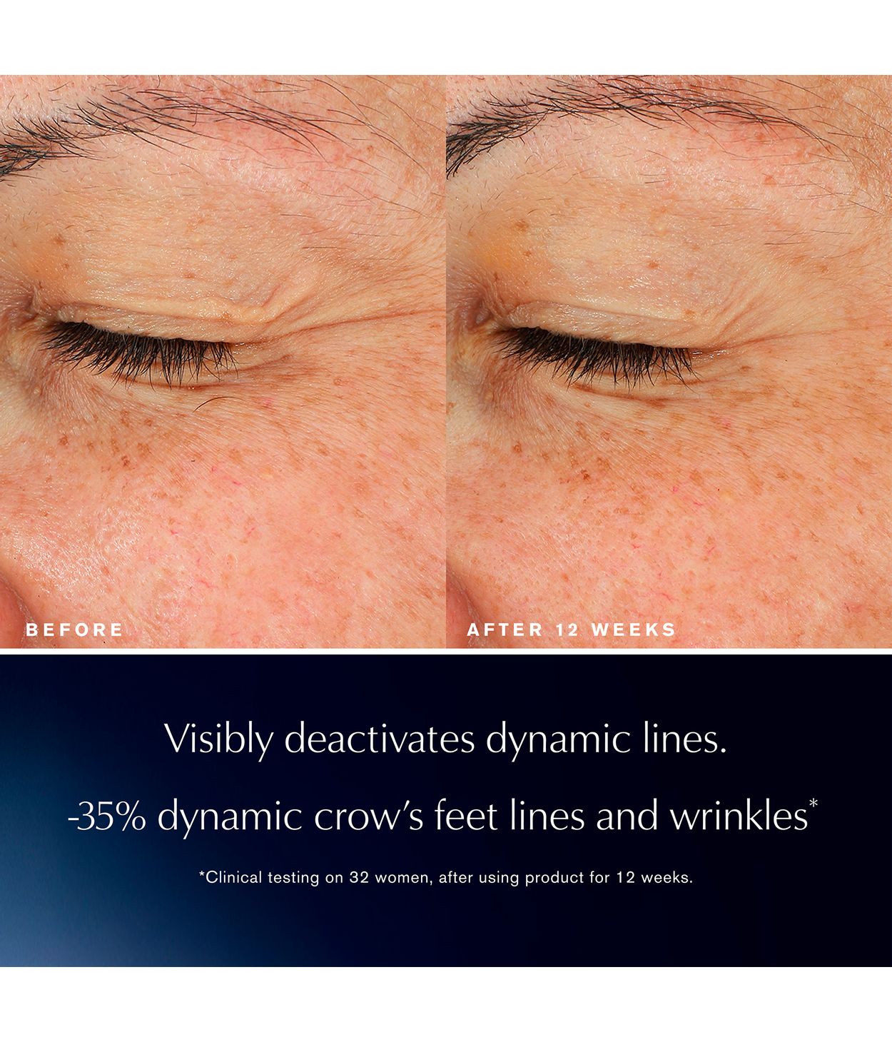 ESTÉE LAUDER Advanced Night Repair Eye Lift+Sculpt