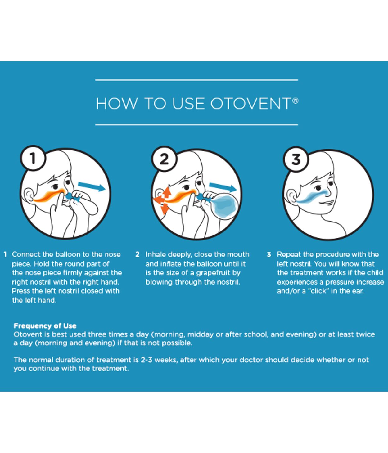 Otovent við undirþrýstingi í miðeyra