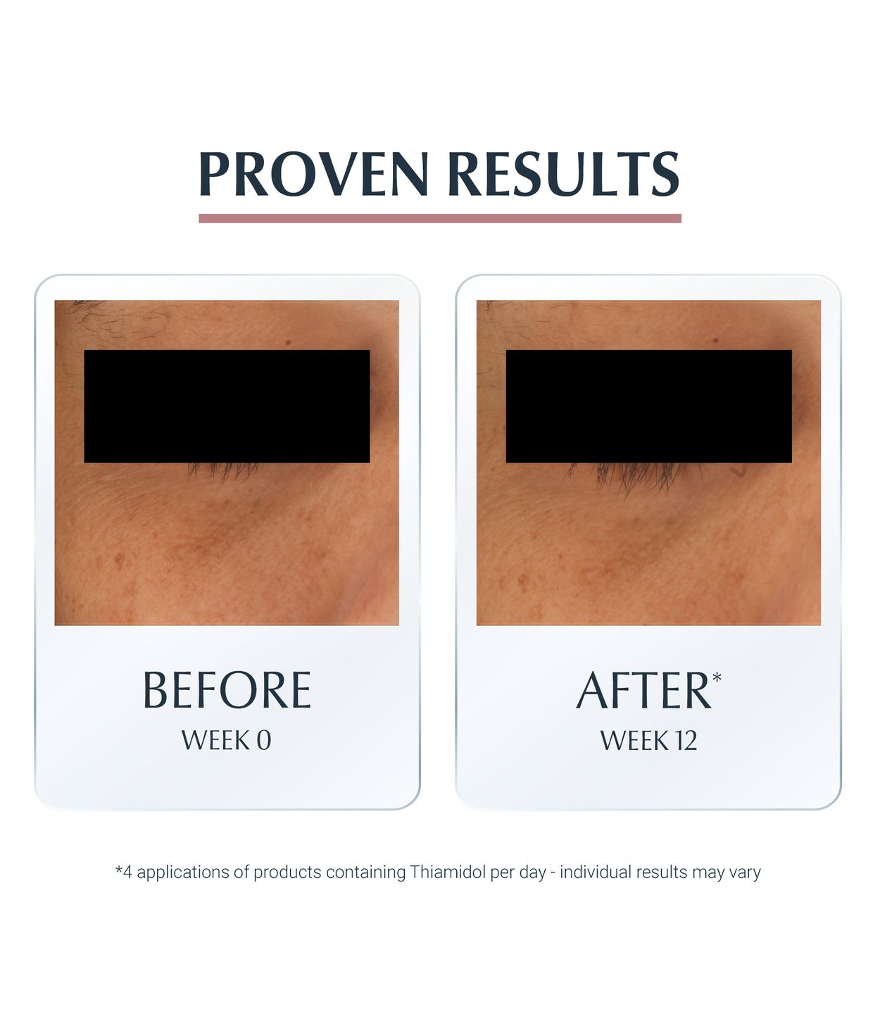 Eucerin Anti-Pigment Illuminating Eye Care 15ml