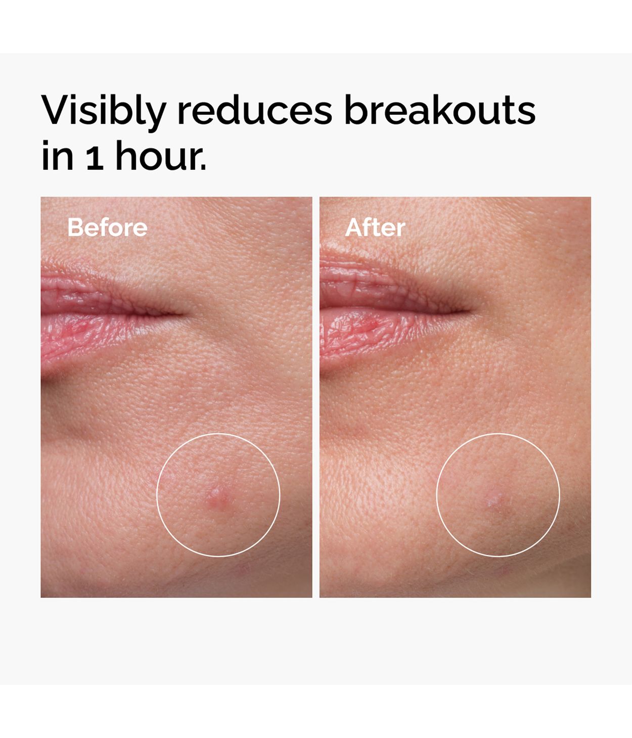 The Ordinary Sulfur 10% Powder To Cream 5g